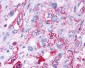 CRHR2 / CRF2 Receptor Antibody (Extracellular Domain)